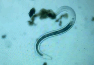 Microscopic nematode worm found in a compost sample.